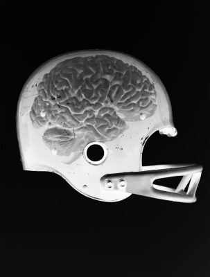 Study Of Junior Seau's Brain Finds Signs Of Neurodegenerative